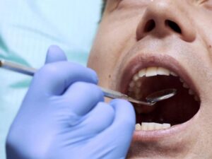 Tumore del cavo orale, la prevenzione si fa con il Rotary