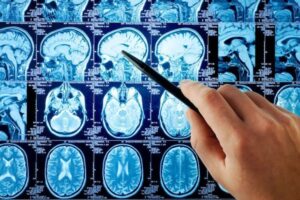 Neurologia a Novi, personale al minimo: sarà affidata ai privati?